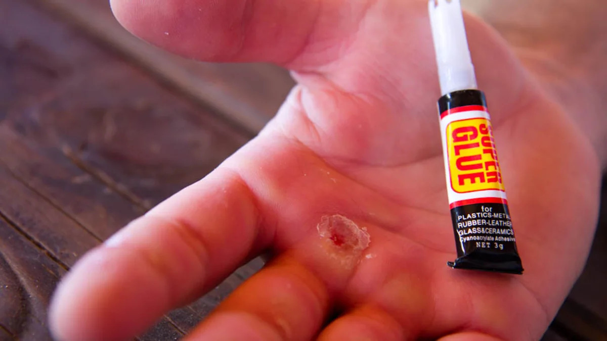 Suri duda compartir ▷ ¿Como quitar el super Glue? 7 formas de quitar este pegamento | FasaWorld